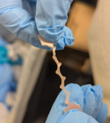 Stretched tendon
